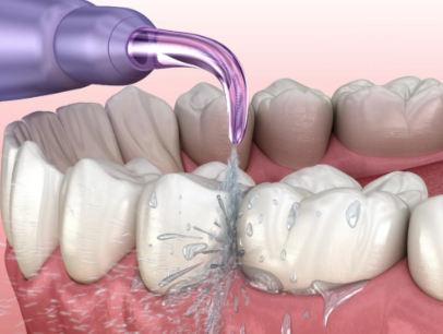 哈尔滨哪个医院看牙好？数字化种植技术精湛收费亲民，亲测效果稳固超赞值得选
