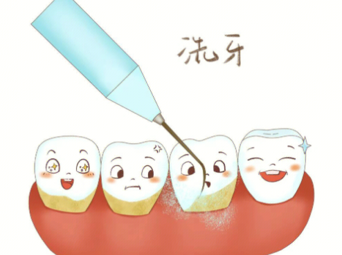 深圳格伦菲尔口腔如何？数字化种植技术精湛且收费亲民，亲测修复效果自然稳固超安心