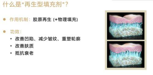 北京佳美整形医院