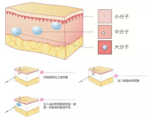 2026 哈尔滨美奇国际整形医院价格表如何规划变美预算？参考这份清晰清单轻松开启焕新之旅。