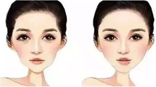 深圳今喜医疗美容门诊全脸脂肪填充价格多少？8000元起透明收费让变美更安心，效果自然值得拥有。