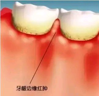 镇江大港牙健康口腔诊所地址在哪？技术精湛收费亲民，院内数字化种植让笑容更自信。