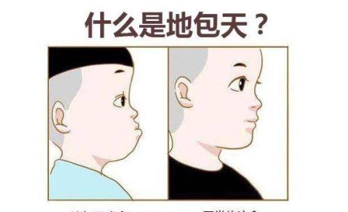 钦州立笑口腔地包天矫正多少钱？1 万起改善侧颜，定制方案让笑容更自信