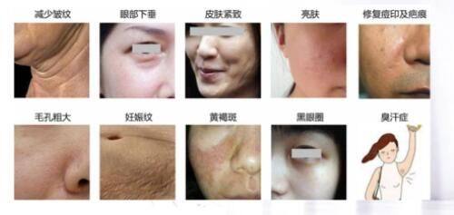 北京奥夕朵医疗美容诊所地址在哪？正规机构技术精湛收费亲民，院内分层注射自然灵动。