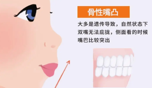 爱诺口腔门诊价格表揭秘！种植牙 3980 元起，矫正 5800 元搞定，省钱攻略快收藏