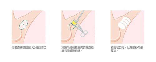 保定悦美整形医院价目表多少钱？透明收费让变美计划轻松落地，安心享受高品质服务。