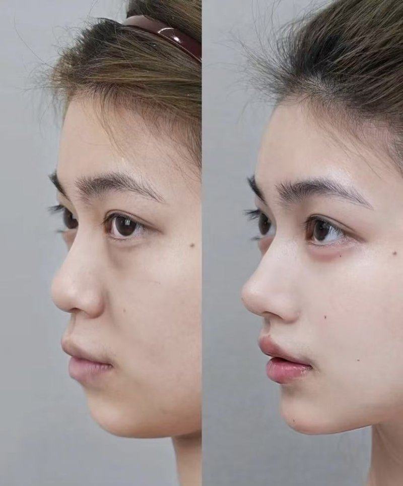 无锡九院整形美容价格表多少钱？透明清单助您轻松规划变美预算，安心开启焕新之旅。