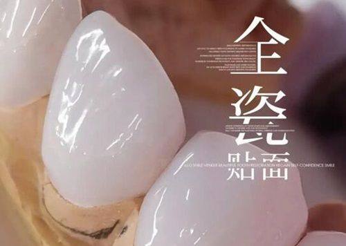 极简海德堡口腔种植牙多少钱一颗？单颗 6800 元起，结合即刻种植技术当天戴牙更省心！