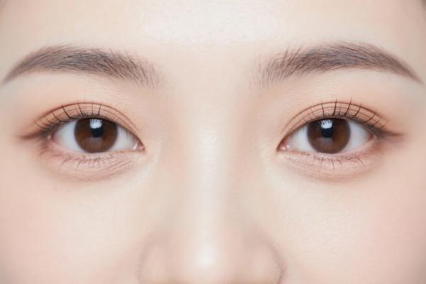 广州米伦整形眼部整形收费标准贵吗？不贵，价格透明合理值得选