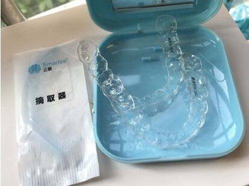 丽水亮贝美口腔种植牙术后反馈怎么样？微创恢复快当天戴牙，多颗缺牙选它