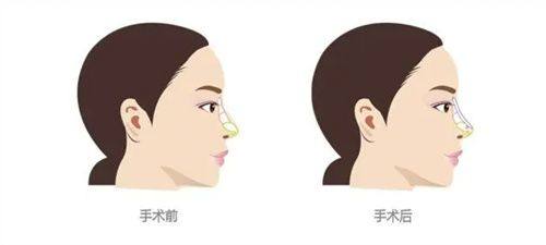 一、韩国釜山西面皮肤科如何预约?三大主流渠道手把手教你快速锁定心仪医院www.360tulou.com/