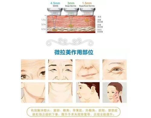 (一)韩国director黛瑞丝医院热门整形项目透明化报价单www.360tulou.com/