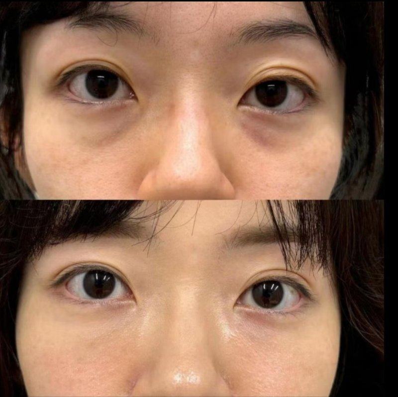 三、韩国皮肤科真实顾客评价与价格参考如何?www.360tulou.com/