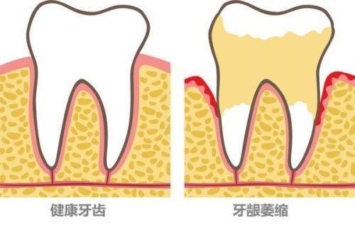 晋城禾木口腔预约什么时间合适？周二上午医生精力足方案准，数字化诊疗高效更省心
