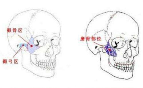 韩国umi皮肤科预约官网入口：首尔Eonni小程序一键查询祛痘坑热玛吉价格