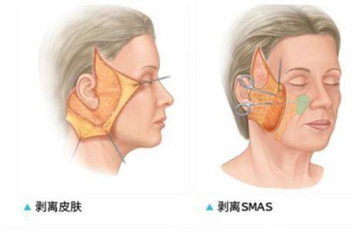 韩国罗薇皮肤科中文预约指南：通过首尔Eonni小程序查院长档期